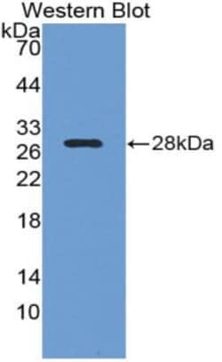 Invitrogen LOXL1 Monoclonal Antibody (C1) 200 &mu;L; Unconjugated:Antibodies,
