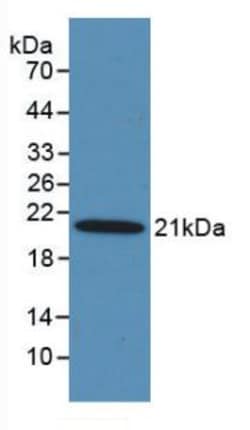 Invitrogen MASP2 Monoclonal Antibody (C3) 200 &mu;L; Unconjugated:Antibodies,