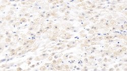 Invitrogen MMP8 Monoclonal Antibody (C8) 200 &mu;L; Unconjugated:Antibodies,