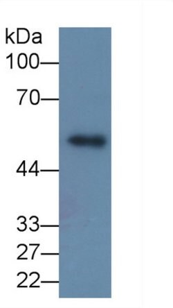 Invitrogen MMP8 Monoclonal Antibody (C8) 200 &mu;L; Unconjugated:Antibodies,