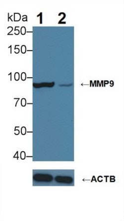 Invitrogen MMP9 Monoclonal Antibody (16#):Antibodies:Primary Antibodies