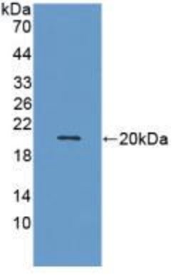 Invitrogen MMP9 Monoclonal Antibody (16#):Antibodies:Primary Antibodies