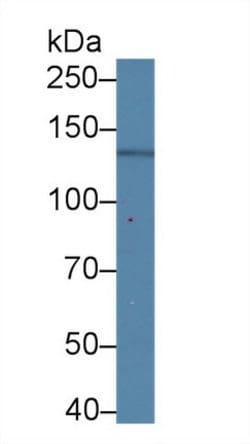 Invitrogen Nephrin Monoclonal Antibody (C8) 200 &mu;L; Unconjugated:Antibodies,