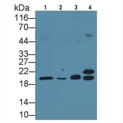 Invitrogen Neurokinin A Monoclonal Antibody (C1) 200 &mu;L | Buy Online | Invitrogen&trade; | Fisher Scientific