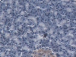 Invitrogen NGAL Monoclonal Antibody (D2) 20 &mu;L; Unconjugated:Antibodies,