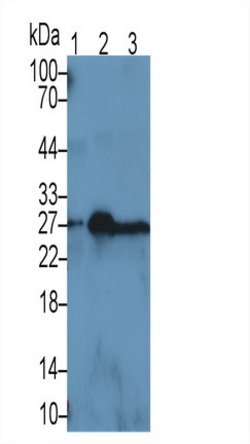 Invitrogen NGAL Monoclonal Antibody (D2) 20 &mu;L; Unconjugated:Antibodies,