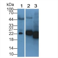 Invitrogen NGAL Monoclonal Antibody (E1):Antibodies:Primary Antibodies