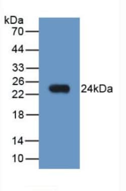 Invitrogen NGAL Monoclonal Antibody (E1) 200 &mu;L; Unconjugated:Antibodies,