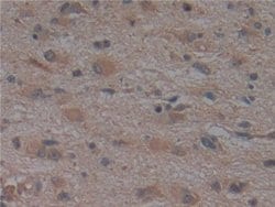 Invitrogen Noggin Monoclonal Antibody (A11) 200 &mu;L; Unconjugated:Antibodies,