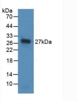 Invitrogen Noggin Monoclonal Antibody (A11) 200 &mu;L; Unconjugated:Antibodies,