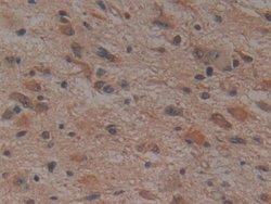 Invitrogen Noggin Monoclonal Antibody (A9) 20 &mu;L; Unconjugated:Antibodies,