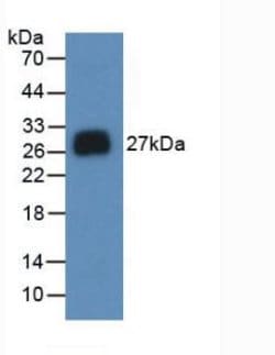 Invitrogen Noggin Monoclonal Antibody (A9) 20 &mu;L; Unconjugated:Antibodies,