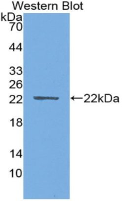 Invitrogen PTHLH Monoclonal Antibody (C5) 20 &mu;L | Buy Online | Invitrogen&trade; | Fisher Scientific