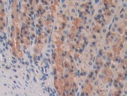 Invitrogen PPAR gamma Monoclonal Antibody (C5):Antibodies:Primary Antibodies