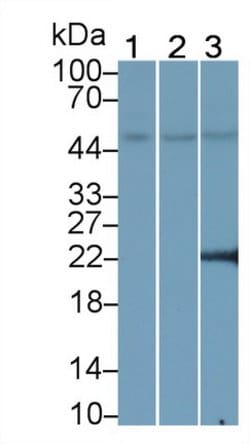 Invitrogen PPAR gamma Monoclonal Antibody (C5):Antibodies:Primary Antibodies