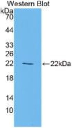 Invitrogen PPAR gamma Monoclonal Antibody (C5):Antibodies:Primary Antibodies