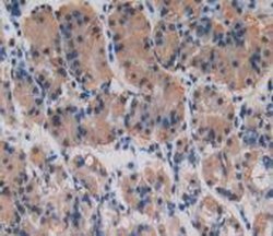 Invitrogen Procollagen I N-Peptide Monoclonal Antibody (C6) 200 &mu;L;