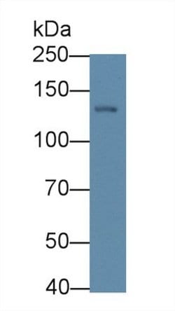 Invitrogen P3NP Monoclonal Antibody (C2):Antibodies:Primary Antibodies