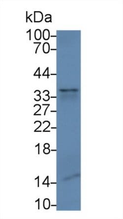 Invitrogen SFTPA1 Monoclonal Antibody (C5):Antibodies:Primary Antibodies
