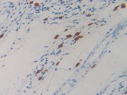 Invitrogen Resistin Monoclonal Antibody (D2):Antibodies:Primary Antibodies