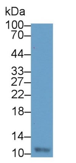 Invitrogen Resistin Monoclonal Antibody (D2):Antibodies:Primary Antibodies