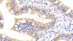 Invitrogen RBP2 Monoclonal Antibody (D2) 20 &mu;L; Unconjugated:Antibodies,