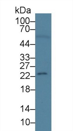 RBP4 Monoclonal Antibody (A2), Invitrogen 200 &mu;L; Unconjugated:Antibodies,