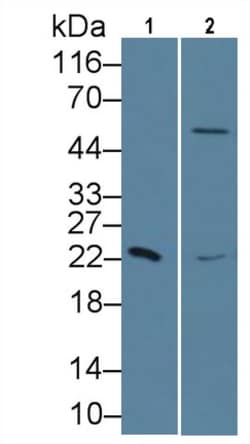 Invitrogen RBP4 Monoclonal Antibody (A2) 20 &mu;L; Unconjugated:Antibodies,