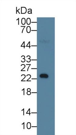 RBP4 Monoclonal Antibody (A2), Invitrogen 200 &mu;L; Unconjugated:Antibodies,