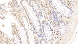 Invitrogen RNASE2 Monoclonal Antibody (C13) 200 &mu;L | Buy Online | Invitrogen&trade; | Fisher Scientific