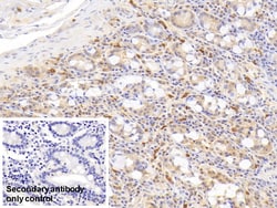 Invitrogen RNASE2 Monoclonal Antibody (C13) 200 &mu;L | Buy Online | Invitrogen&trade; | Fisher Scientific