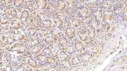Invitrogen RNASE2 Monoclonal Antibody (C13) 200 &mu;L | Buy Online | Invitrogen&trade; | Fisher Scientific