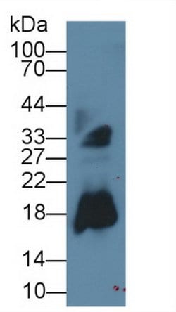 Invitrogen RNASE2 Monoclonal Antibody (C13):Antibodies:Primary Antibodies