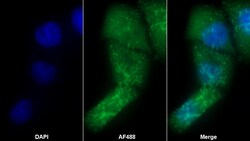 Invitrogen S100A8 Monoclonal Antibody (C2) 200 &mu;L; Unconjugated:Antibodies,