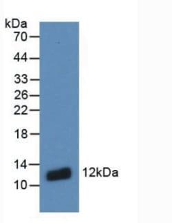 Invitrogen S100A8 Monoclonal Antibody (C2) 200 &mu;L; Unconjugated:Antibodies,