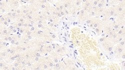 Invitrogen S100A9 Monoclonal Antibody (H2) 20 &mu;L; Unconjugated:Antibodies,