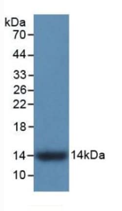 Invitrogen S100A9 Monoclonal Antibody (H2) 200 &mu;L; Unconjugated:Antibodies,