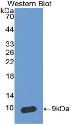 Invitrogen SERPINB4 Monoclonal Antibody (H10):Antibodies:Primary Antibodies