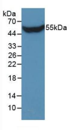 Invitrogen STC1 Monoclonal Antibody (C13):Antibodies:Primary Antibodies