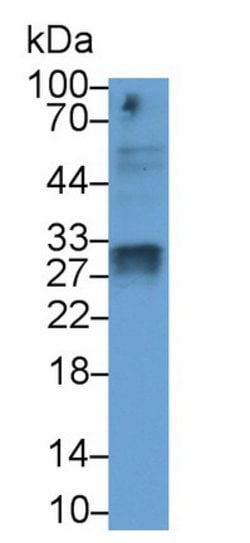 Invitrogen SOD3 Monoclonal Antibody (C1):Antibodies:Primary Antibodies