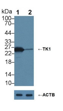 Invitrogen TK1 Monoclonal Antibody (C3):Antibodies:Primary Antibodies