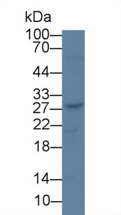 Invitrogen TK1 Monoclonal Antibody (C3) 200 &mu;L; Unconjugated:Anticuerpos