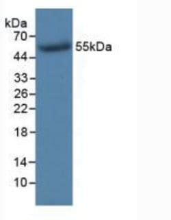 Invitrogen TK1 Monoclonal Antibody (C3):Antibodies:Primary Antibodies
