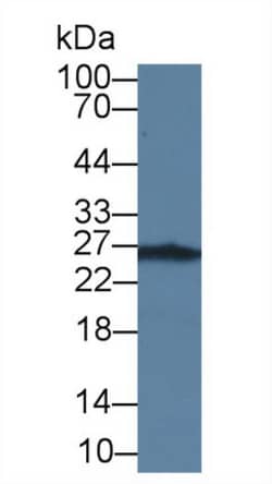 Invitrogen TK1 Monoclonal Antibody (C3) 200 &mu;L; Unconjugated:Anticuerpos