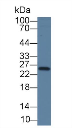 Invitrogen TK1 Monoclonal Antibody (C3) 200 &mu;L; Unconjugated:Anticuerpos