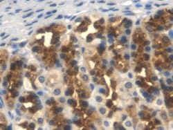 Invitrogen TFPI Monoclonal Antibody (1#) 200 &mu;L; Unconjugated:Antibodies,
