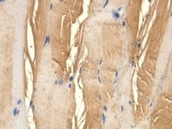 Invitrogen TFPI Monoclonal Antibody (1#) 200 &mu;L; Unconjugated:Antibodies,