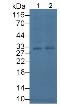Invitrogen TFPI Monoclonal Antibody (1#):Antibodies:Primary Antibodies