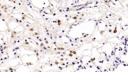 Invitrogen TLR5 Monoclonal Antibody (8-1#):Antibodies:Primary Antibodies