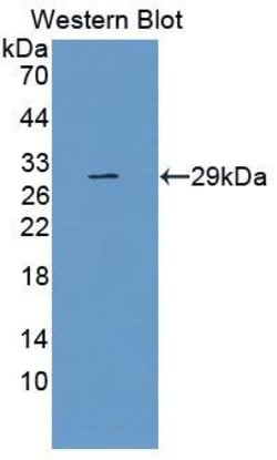 Invitrogen TLR5 Monoclonal Antibody (8-1#):Antibodies:Primary Antibodies
